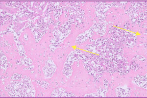 illustrating mesenchymal cells