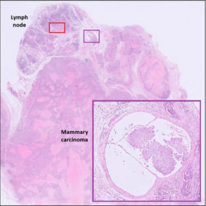 including lymph node.