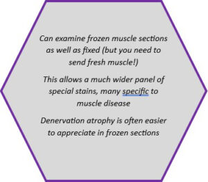Advantages of specialist neuromuscular laboratory