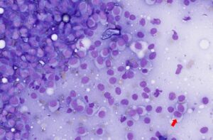 Figure 12 – Cytological features of a histiocytoma