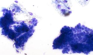 Figure 13 – Cytological features 