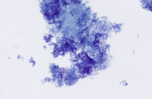 Figure 14 – Cytological features 