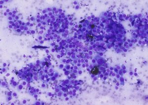Figure 17 – Cytological features 