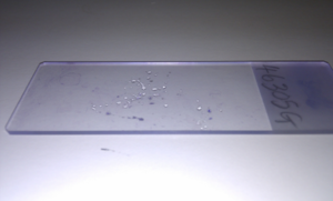 Figure 2. A very thin FNA smear