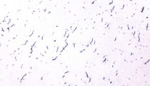 Figure 4. Smear distortion 