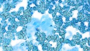 Figure 6. Formalin fume artefact 