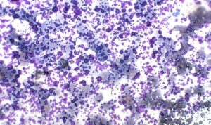 Figure 7. Ultrasound or lubricating gel 